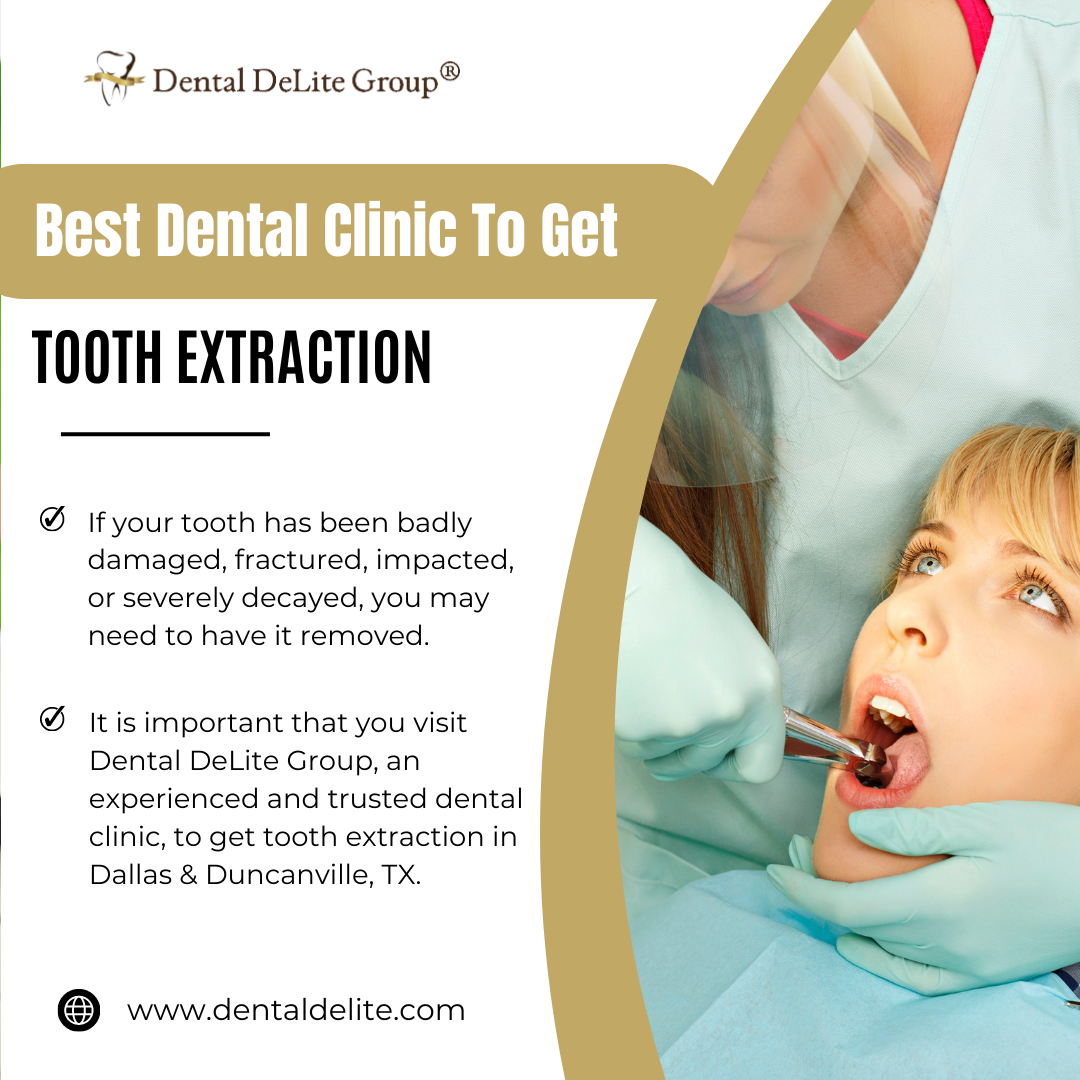 Best Dental Clinic To Get Tooth Extraction in Dallas & Duncanville, TX
