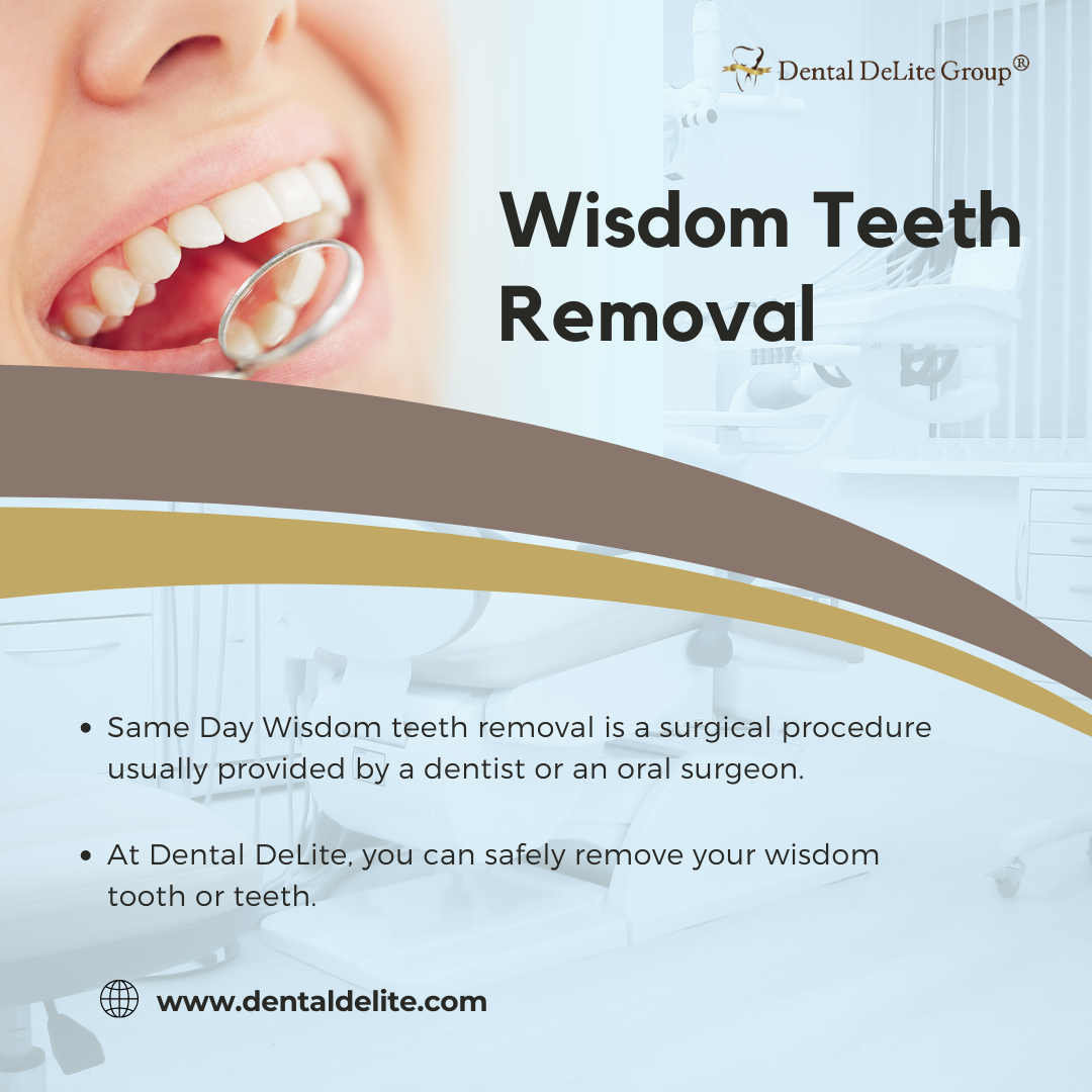 Same Day Wisdom Teeth Removal in Dallas & Duncanville, TX