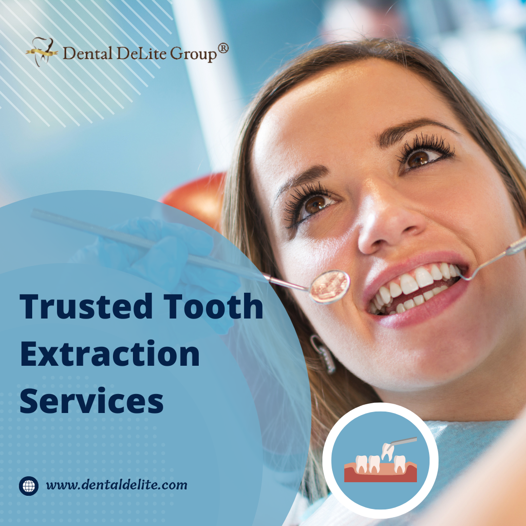 Trusted Tooth Extraction Services in Dallas & Duncanville, TX