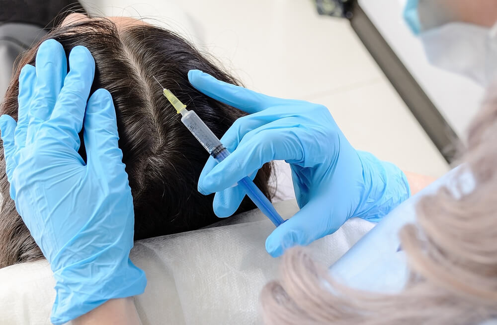 woman receiving hair restoration treatment