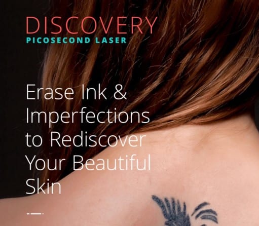 Laser Tattoo Removal Treatment in Manhattan - Sobel Skin