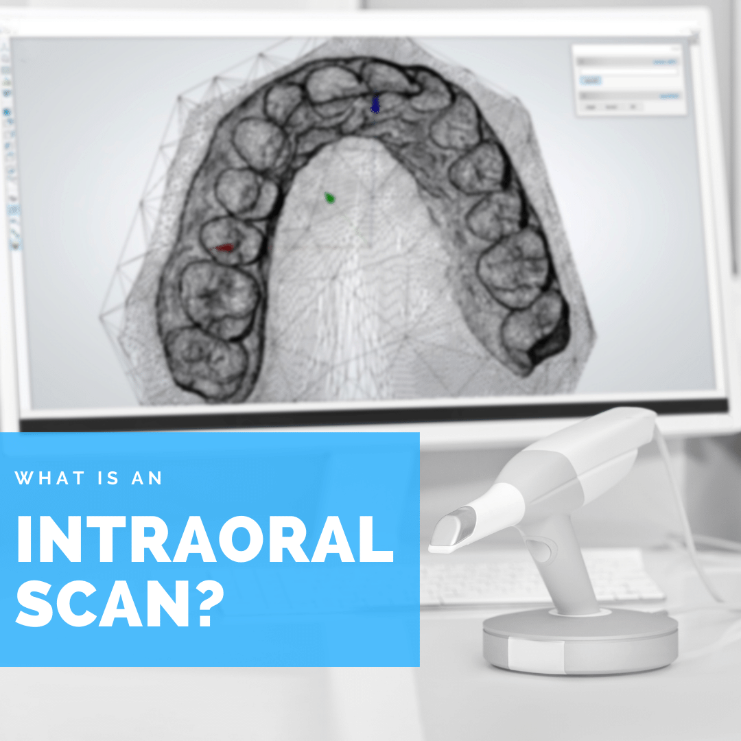 What is an intraoral scan