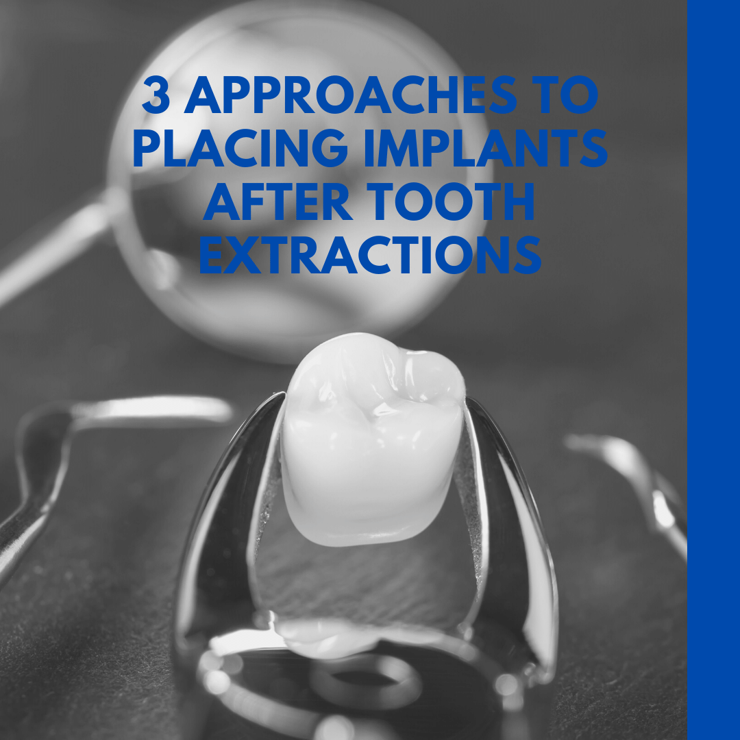 3 Approaches to Placing Implants after tooth extractions