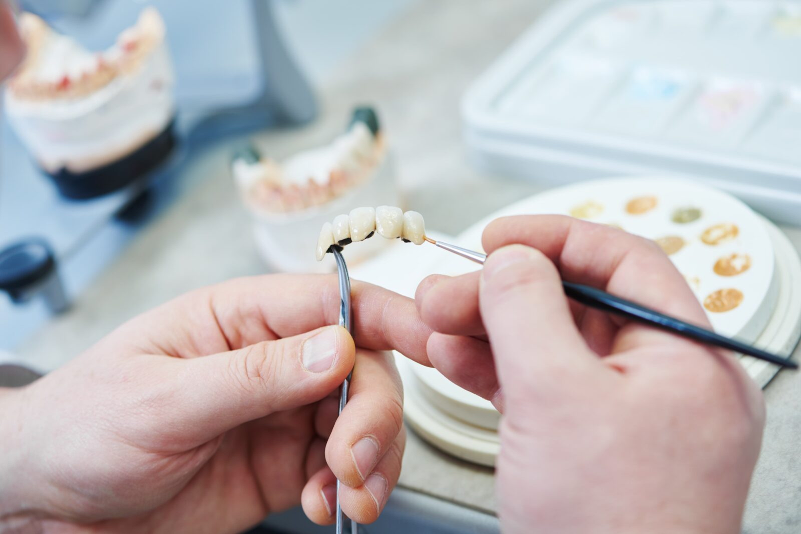 prosthetic teeth being fabricated by hand
