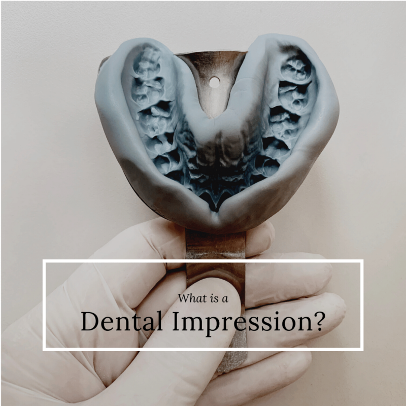 What is a Dental Impression