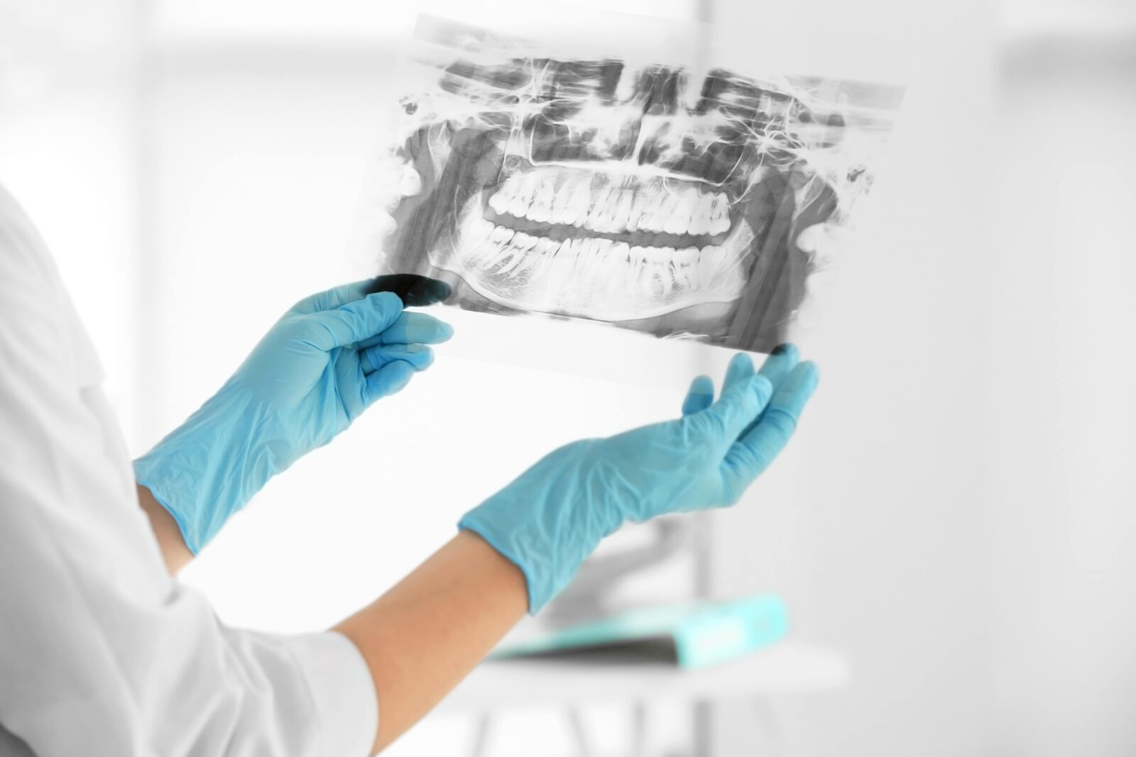 gloved hands holding dental x-ray