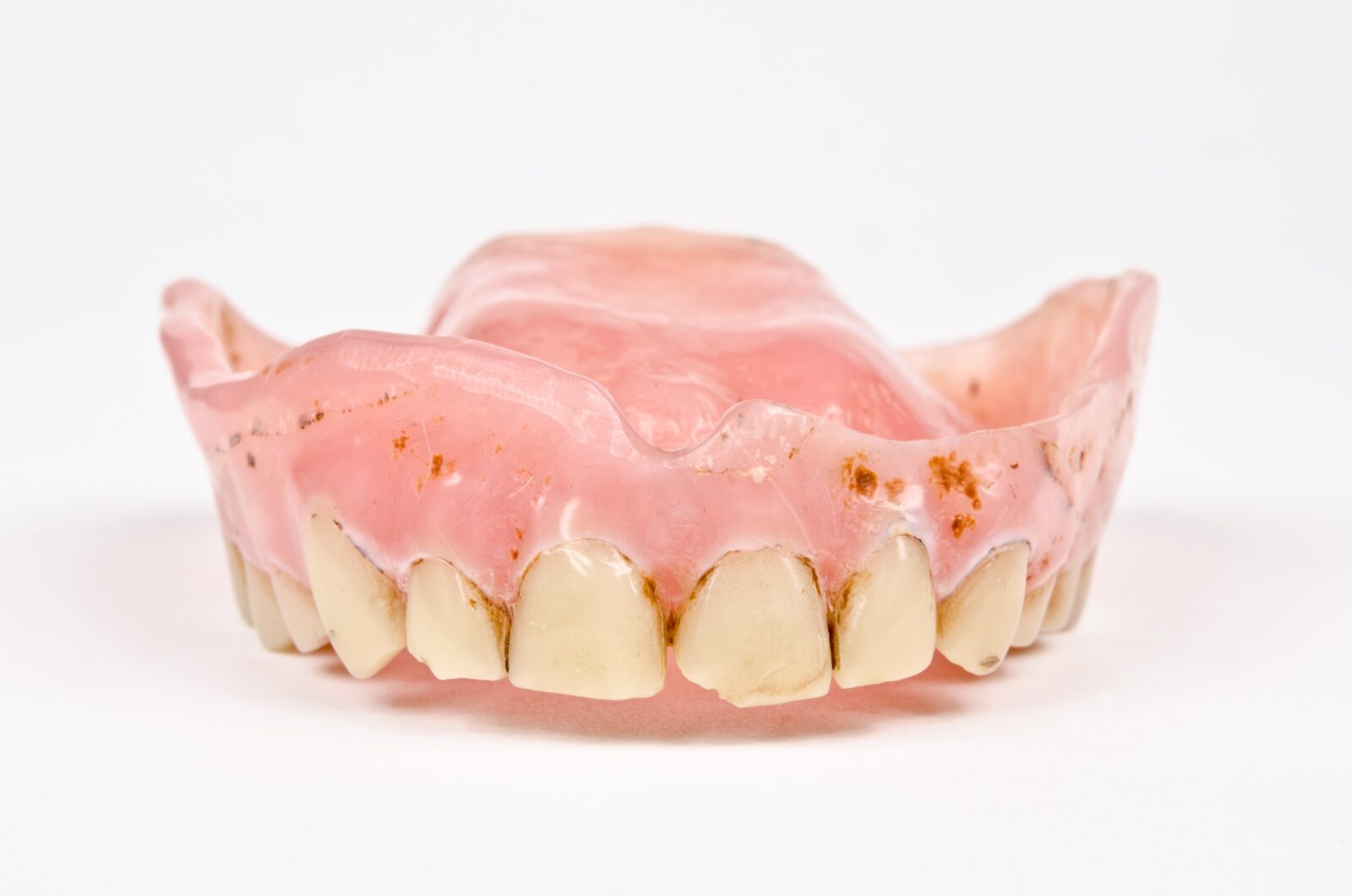 stained and worn denture