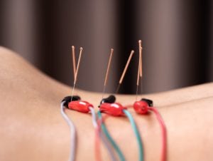 wires on a persons back