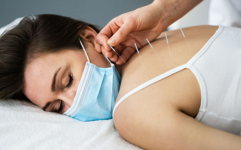 Woman Experiencing Dry Needling Treatment