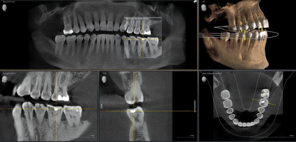 shutterstock 2763470849 showing the concept of 3-D Cone Beam Imaging