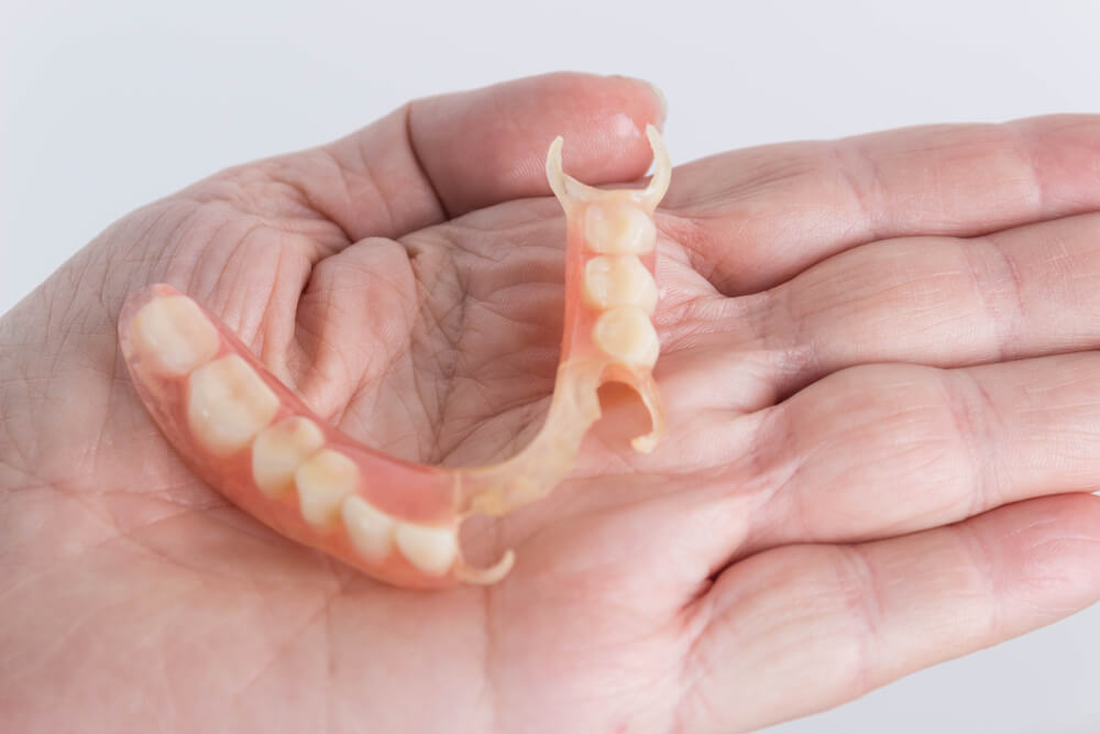 Parietal dentures showing the concept of Services