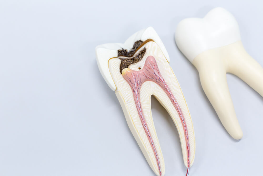 Root canals showing the concept of Services