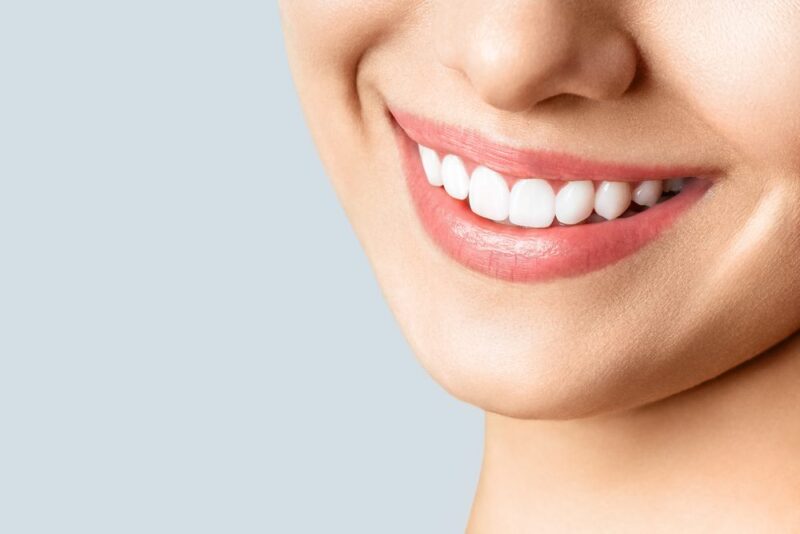 Teeth Whitening Chestermere Smiles showing the concept of Blog