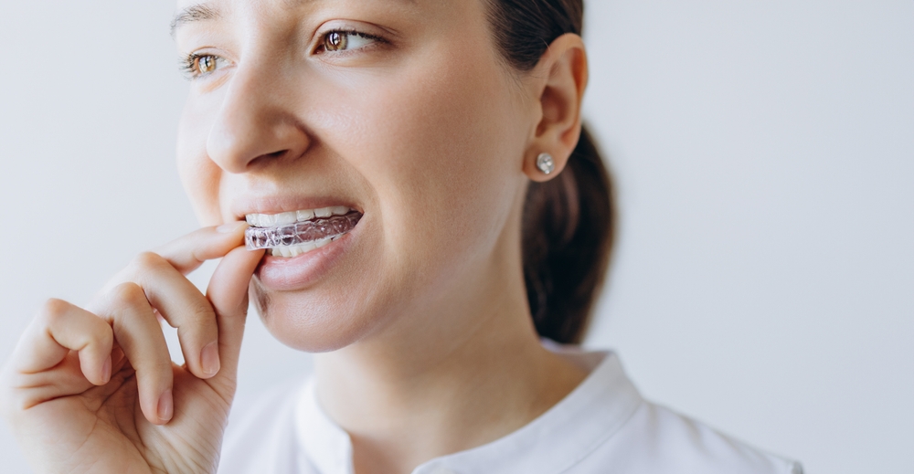 Home 7 used to demonstrate the concept of Home Orthodontic Treatment showing the concept of Home