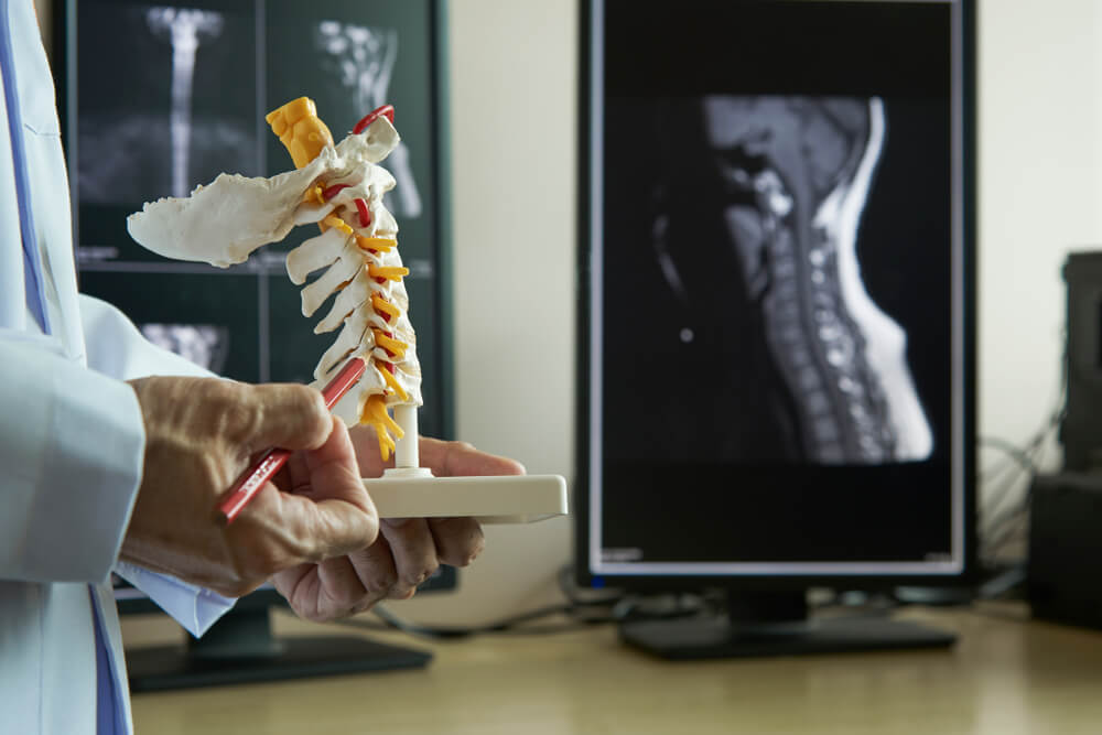 Spinal Disorders showing the concept of Treatments