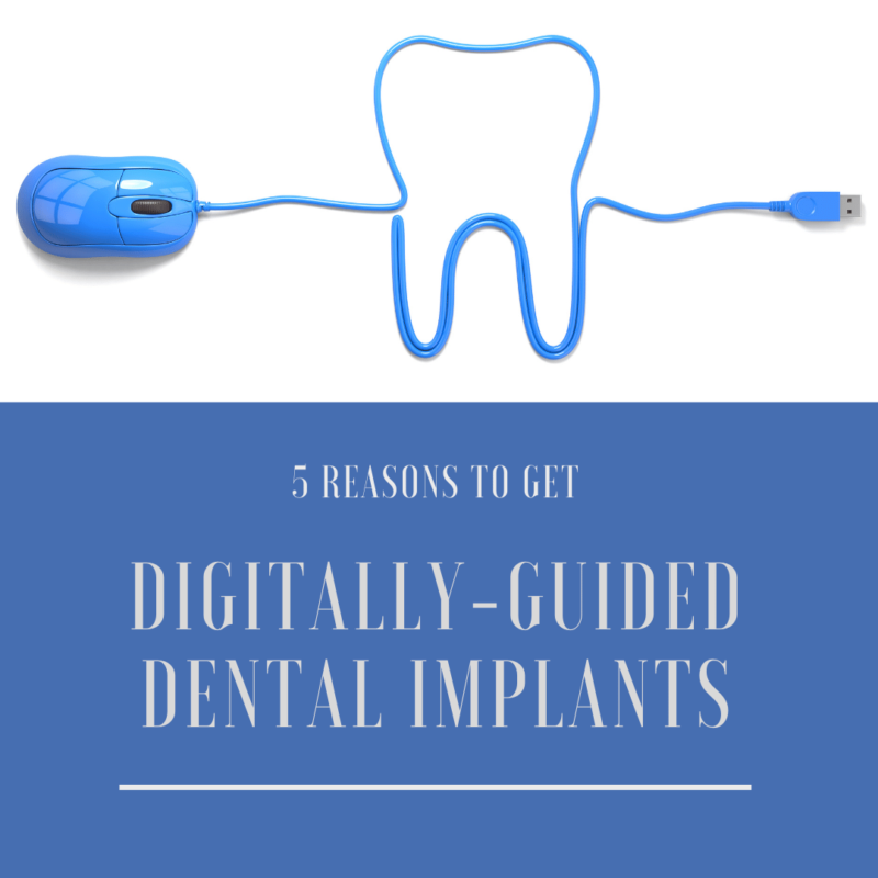 5 Reasons to Get Digitally Guided Dental Implants