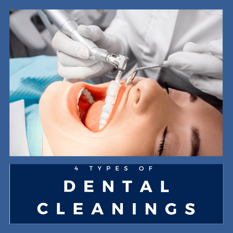 4 Types of dental cleanings