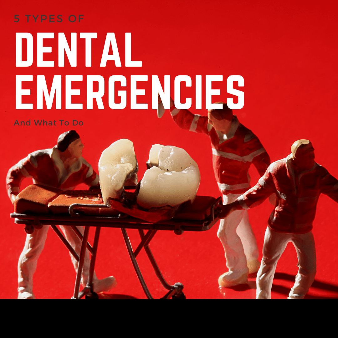 5 Types of dental emergencies and what to do