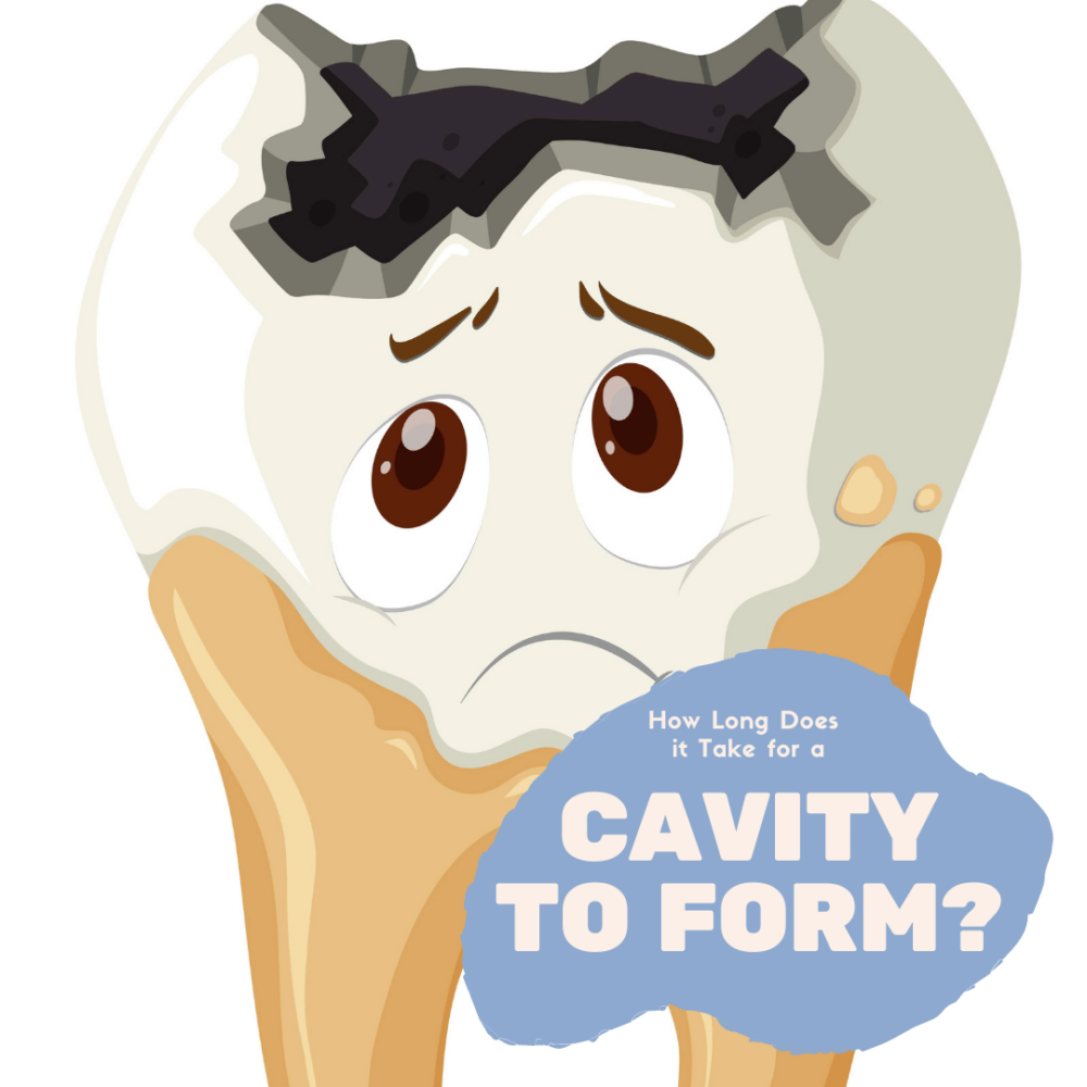 How Long Does it Take a Cavity to Form? Raleigh, NC Sedation Dental