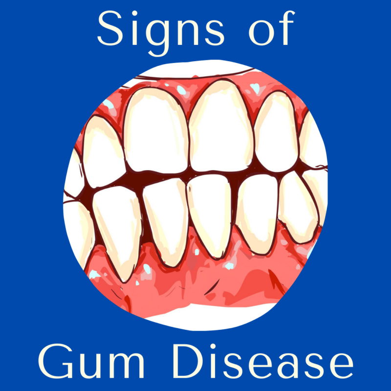 Signs of gum disease