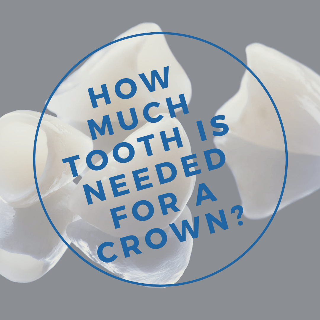 How Much Tooth is Needed for a Crown