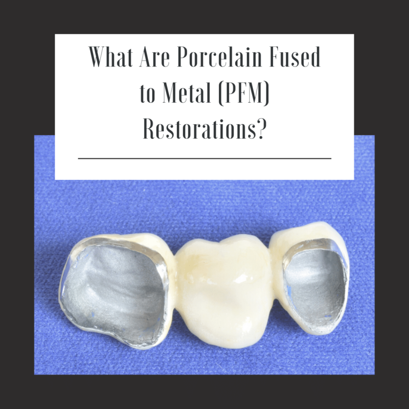 PFM restorations