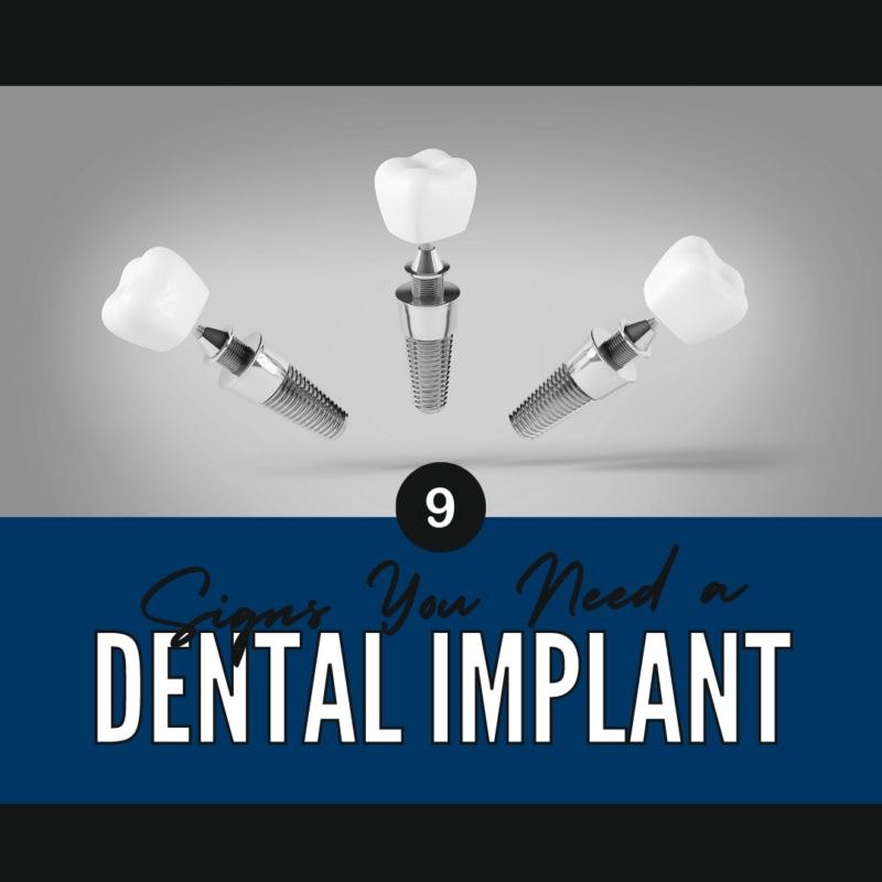 Signs You Need a Dental Implant
