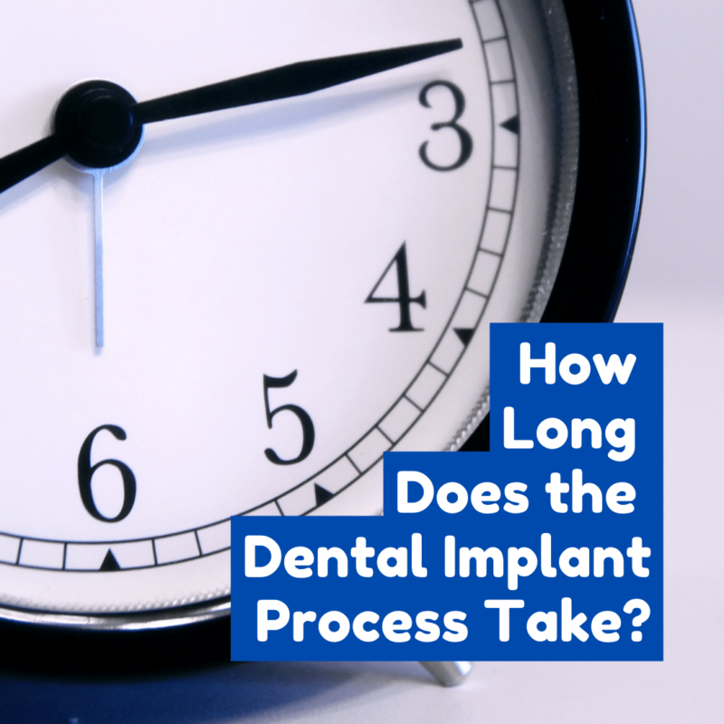 How Long Does the Dental Implant Process Take
