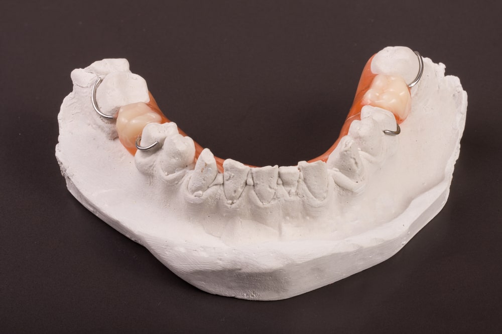 partial denture on a model of teeth