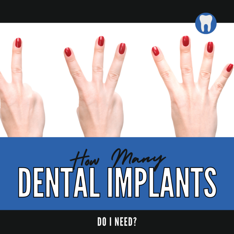 How Many Dental Implants Do I Need