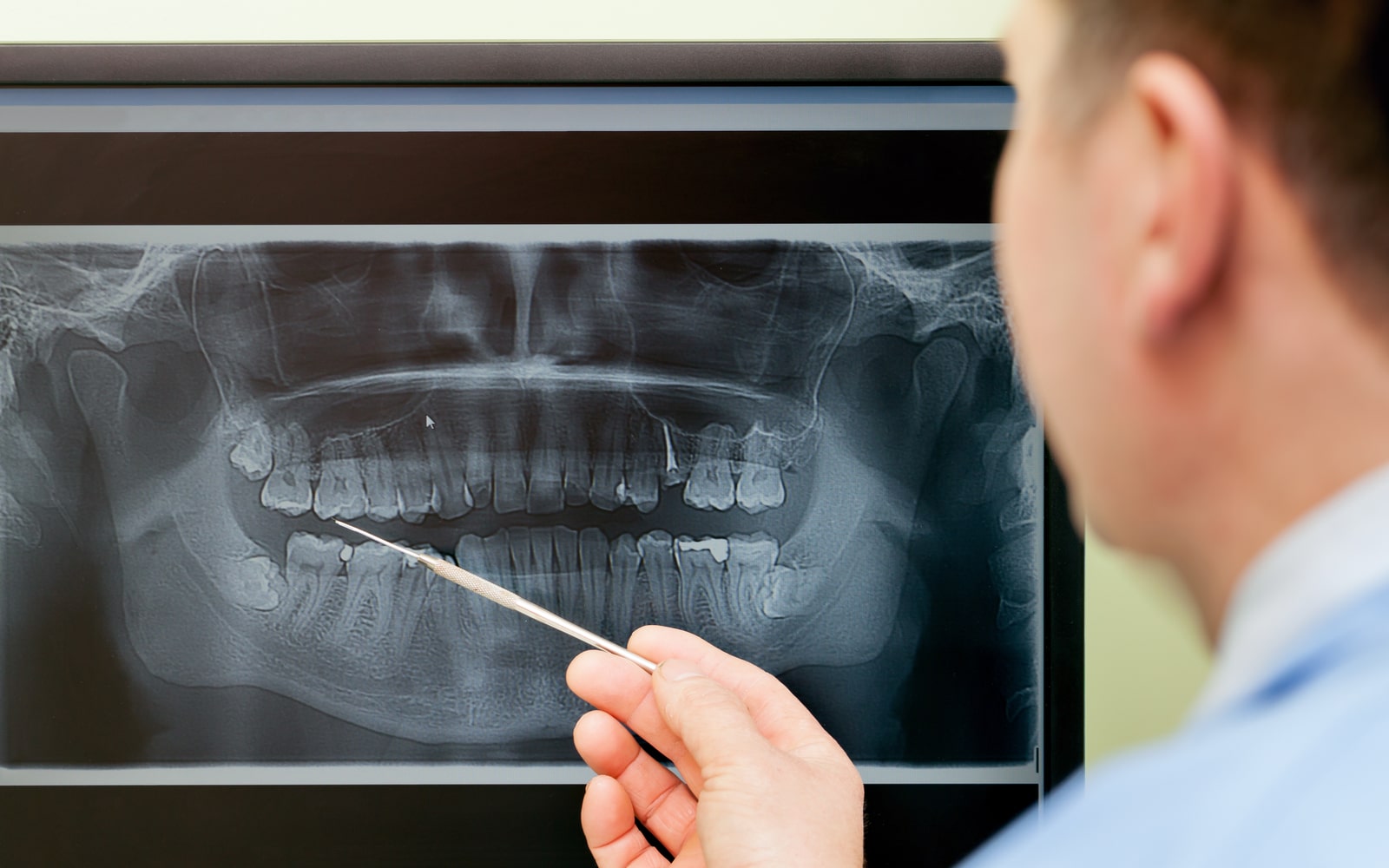 Dental X-Ray Being Viewed By Dentist