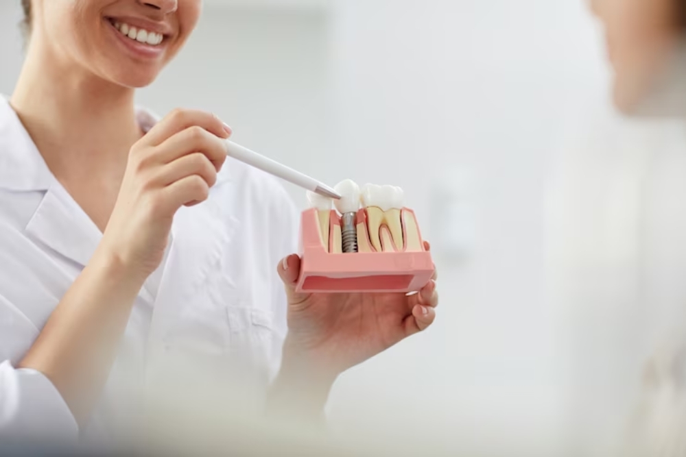 Dental Implants, Tooth Replacement