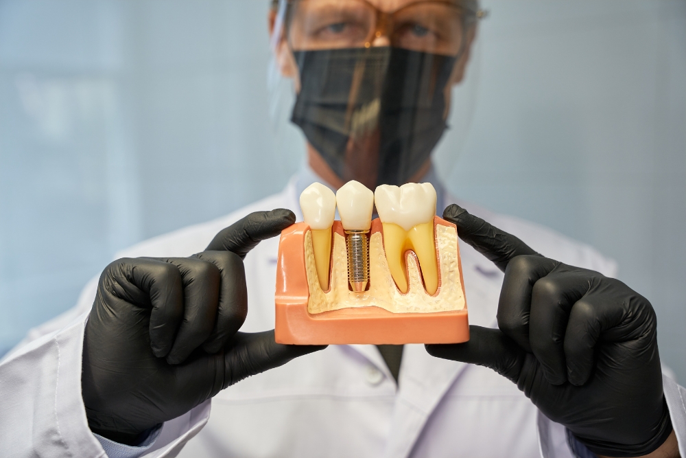 dental implant