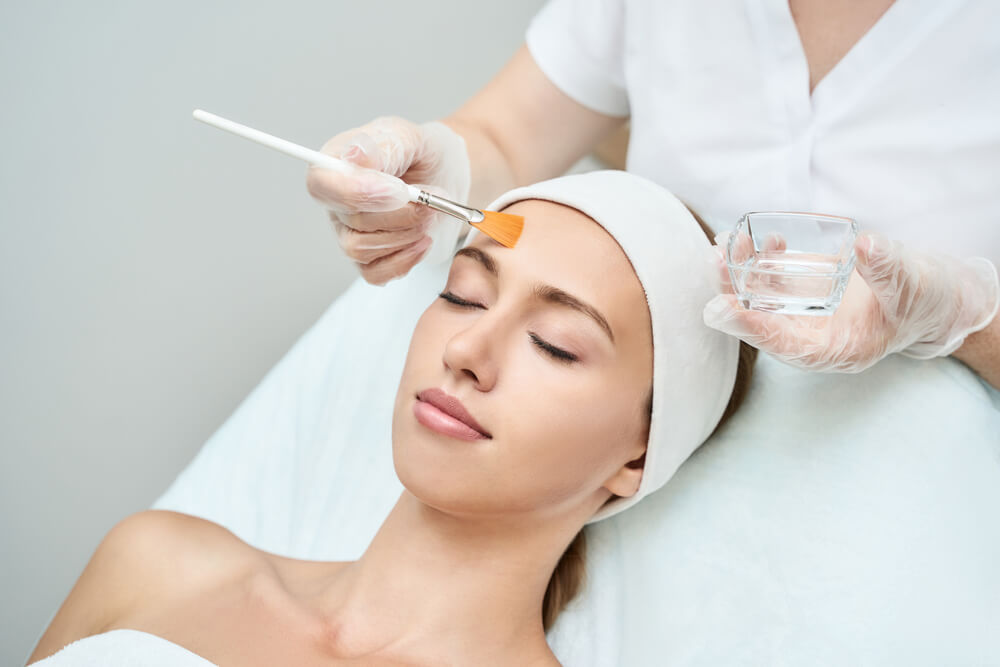 Chemical-peel-for-acne