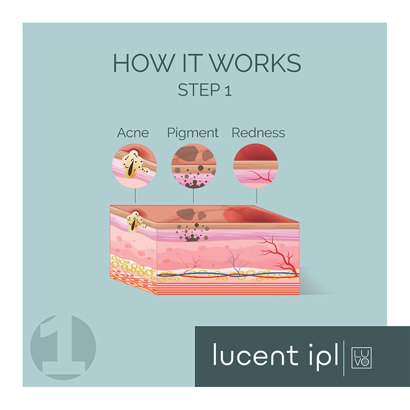 LUCENT-IPL_How-It-Works_1