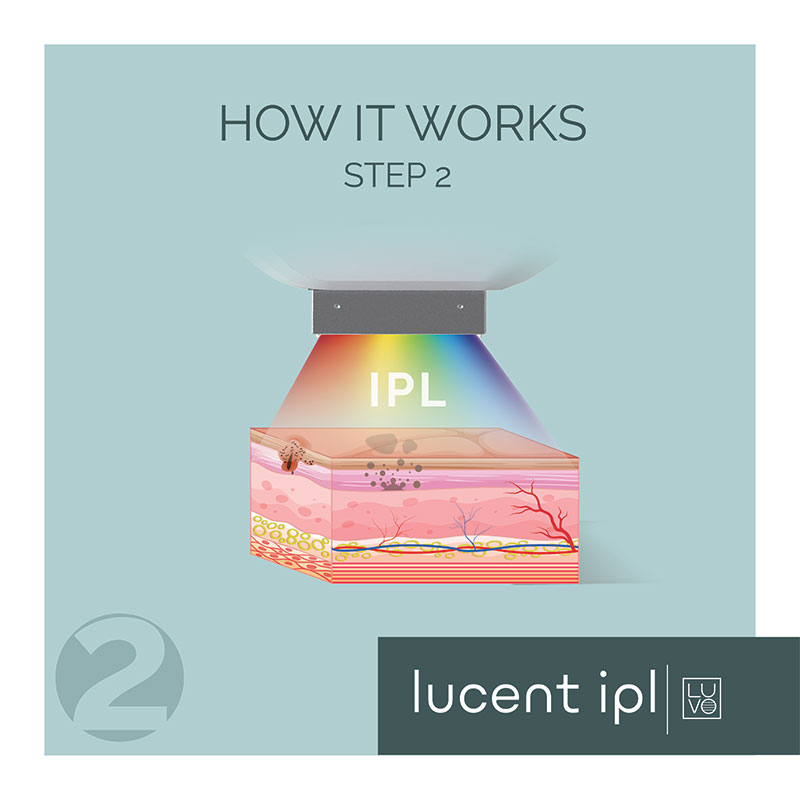 LUCENT-IPL_How-It-Works_2