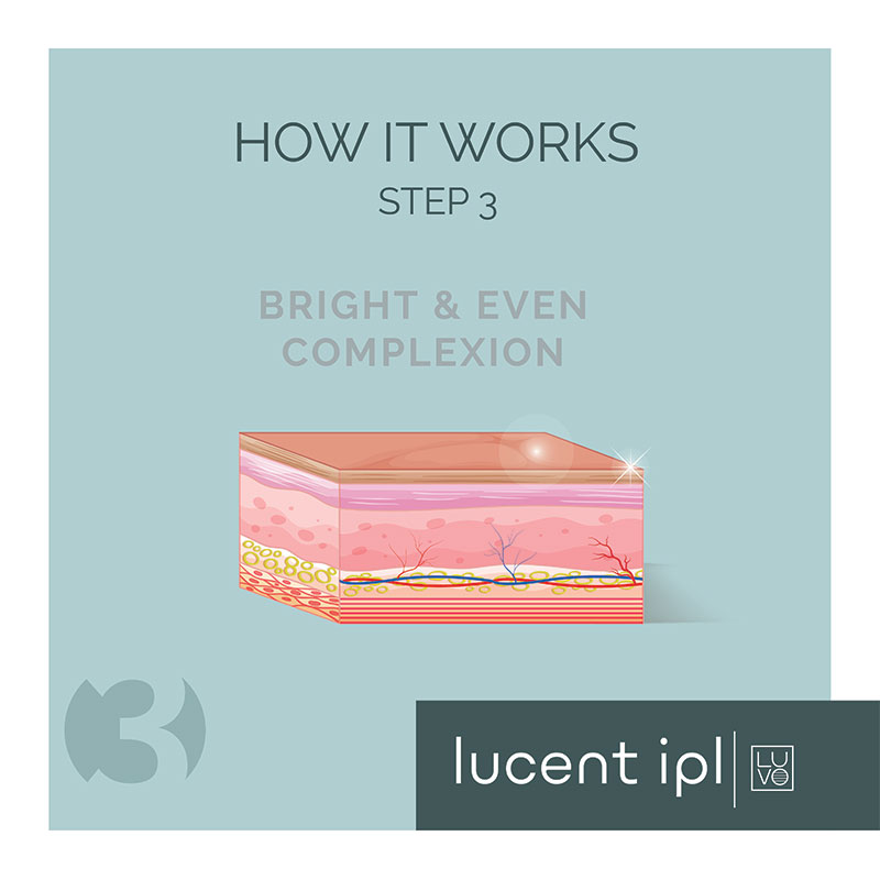 LUCENT-IPL_How-It-Works_3