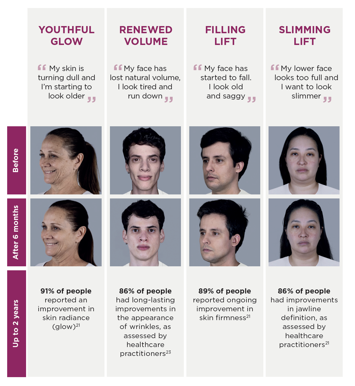 Sculptra before and after