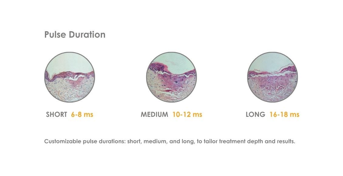 tixel resurfacing treatment