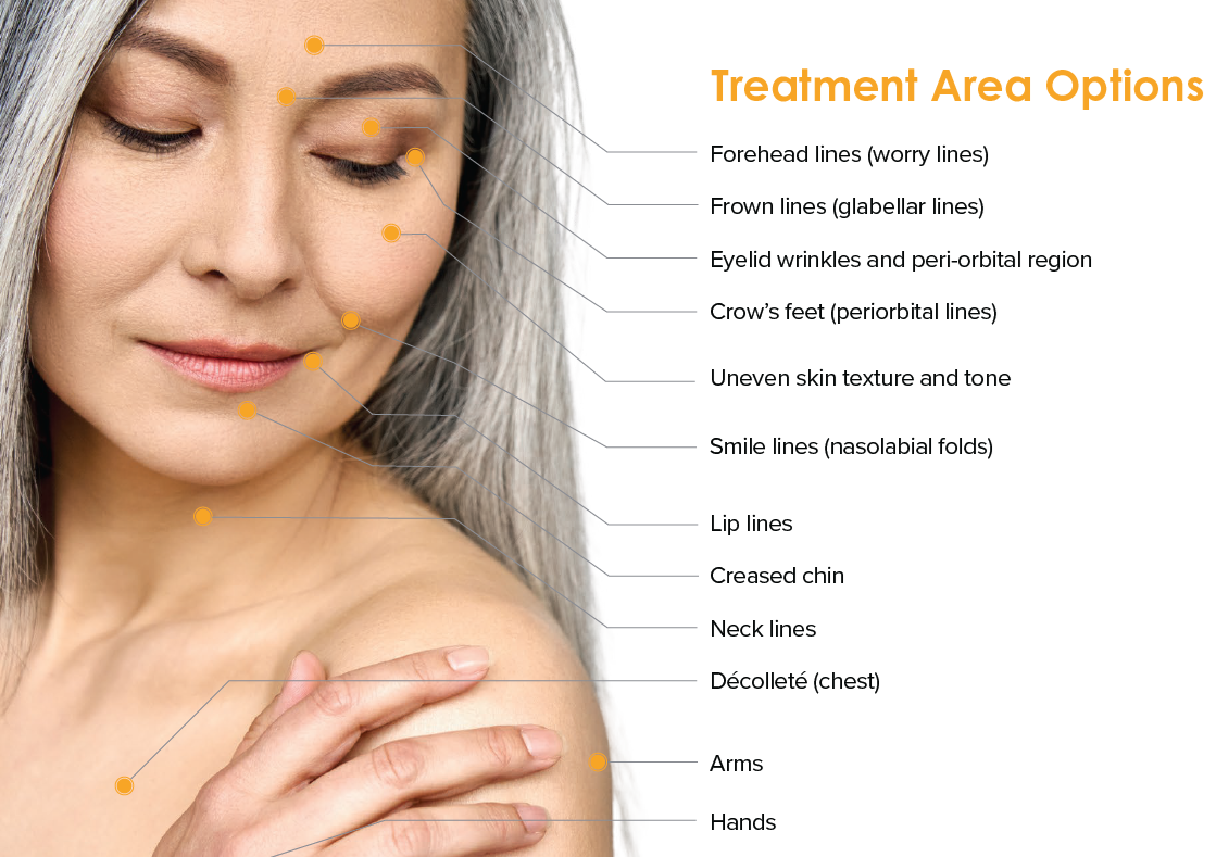 tixel fractional resurfacing treatment