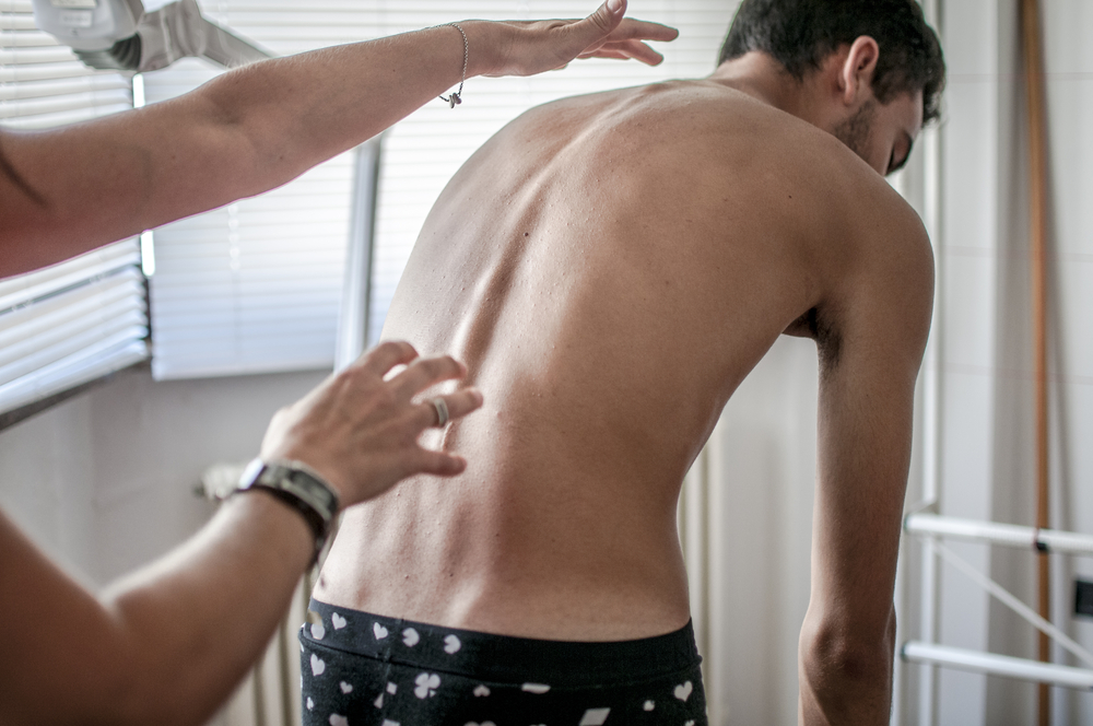 Man with Scoliosis back problem