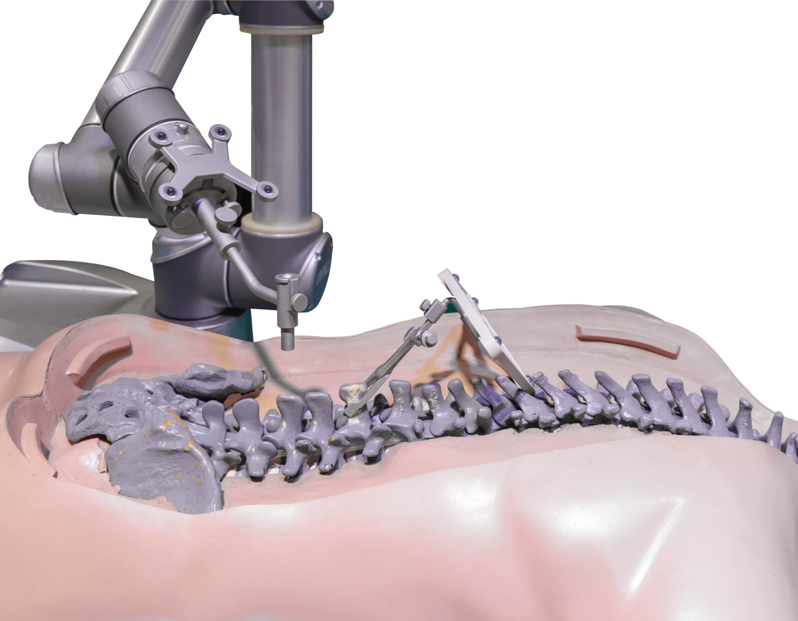 5fe37b f64f819b43e84a7193de6e5b94bf63fd mv2 showing the concept of Robotic Spine Surgery & Augmented Reality