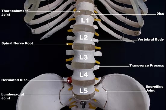 Lumbar Spine Labelled showing the concept of What is a Spinal Disc?