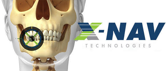 x-nav technologies