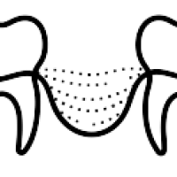 bone grafting icon