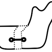 jaw reconstruction icon