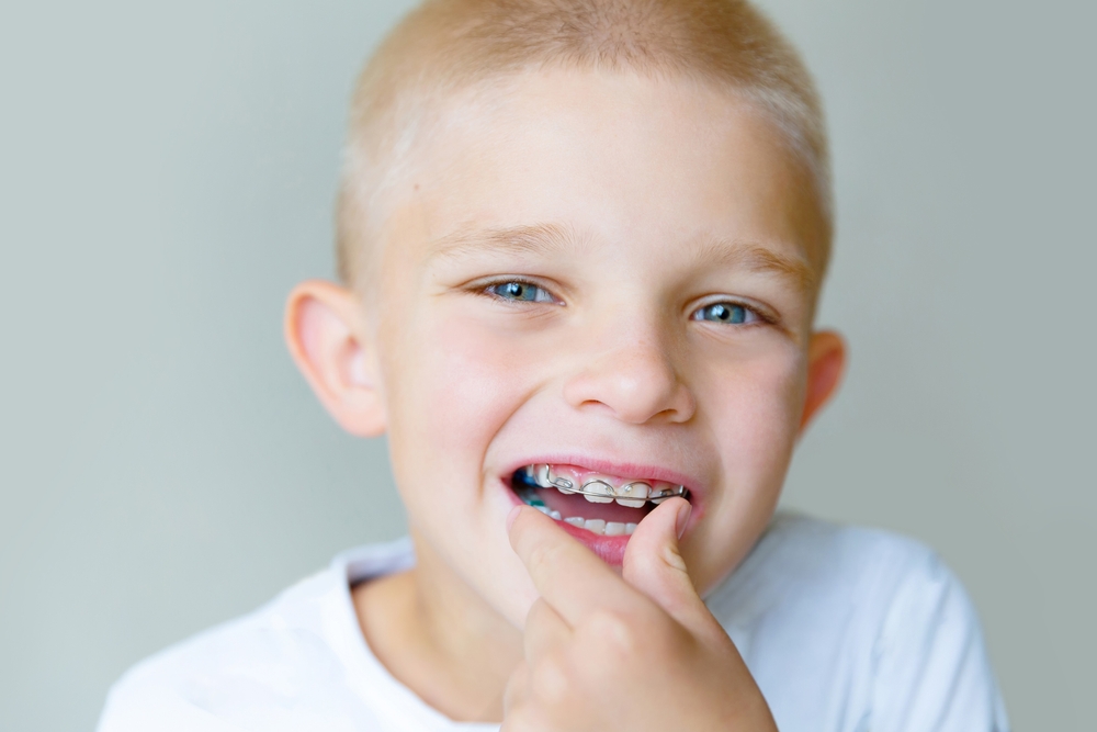 blond-haired boy inserts an orthodontic plate into his mouth to align his teeth