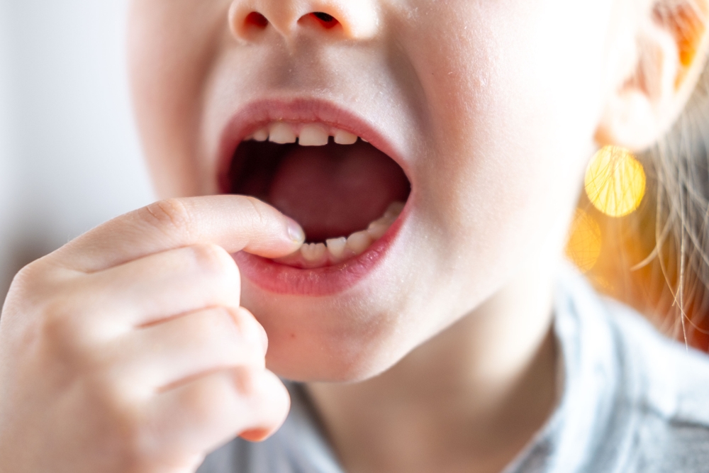 small child, blonde girl 6 years old points new tooth fang in mouth with finger