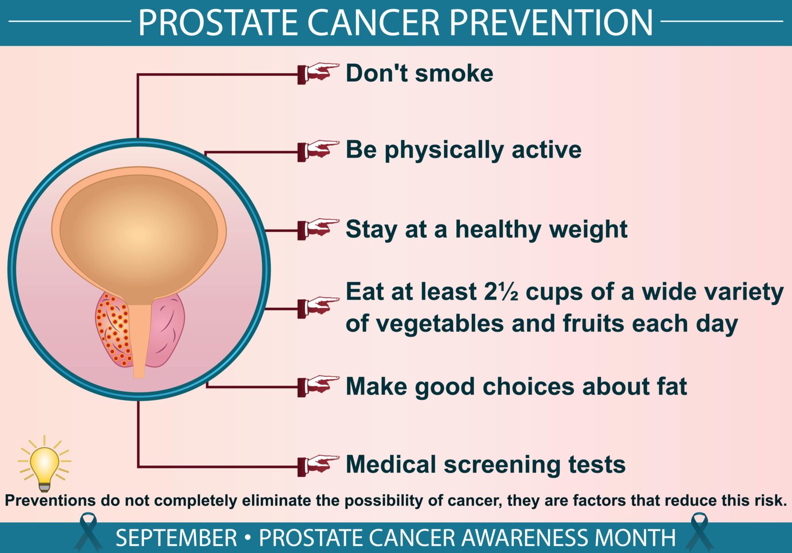 prostate cancer prevention infographic