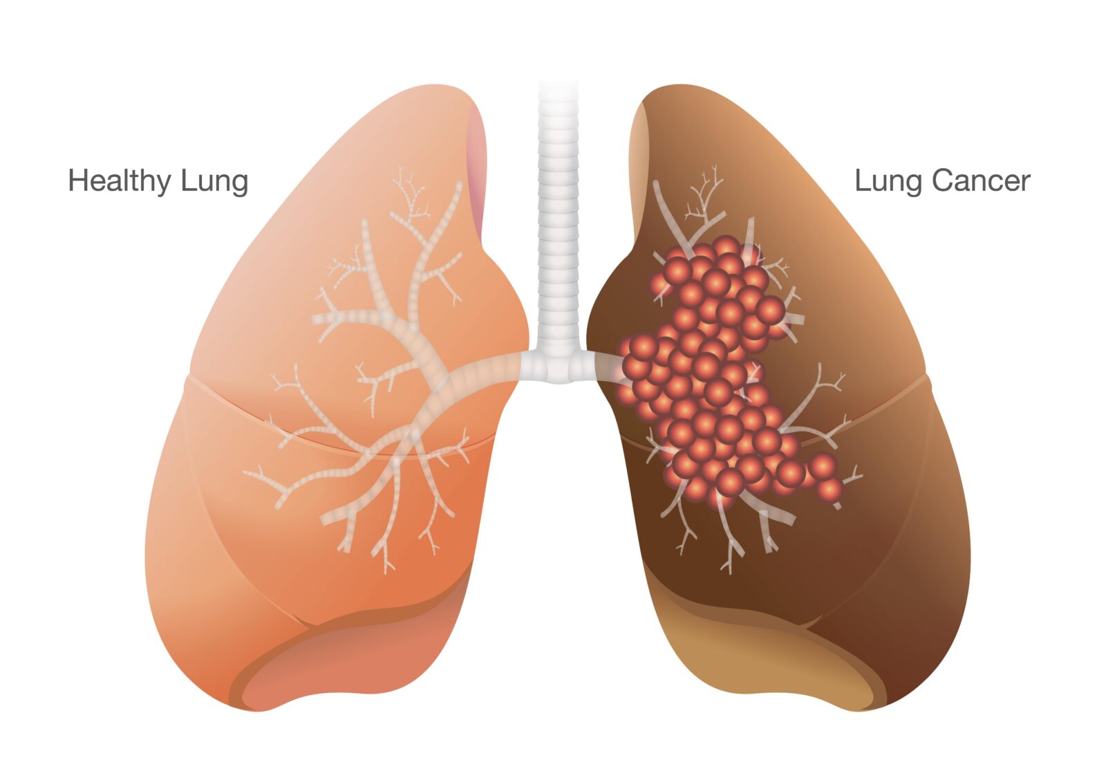 healthy vs. cancerous lung